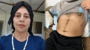 Eniştesini Yaraladı, Ablasını Öldürdü