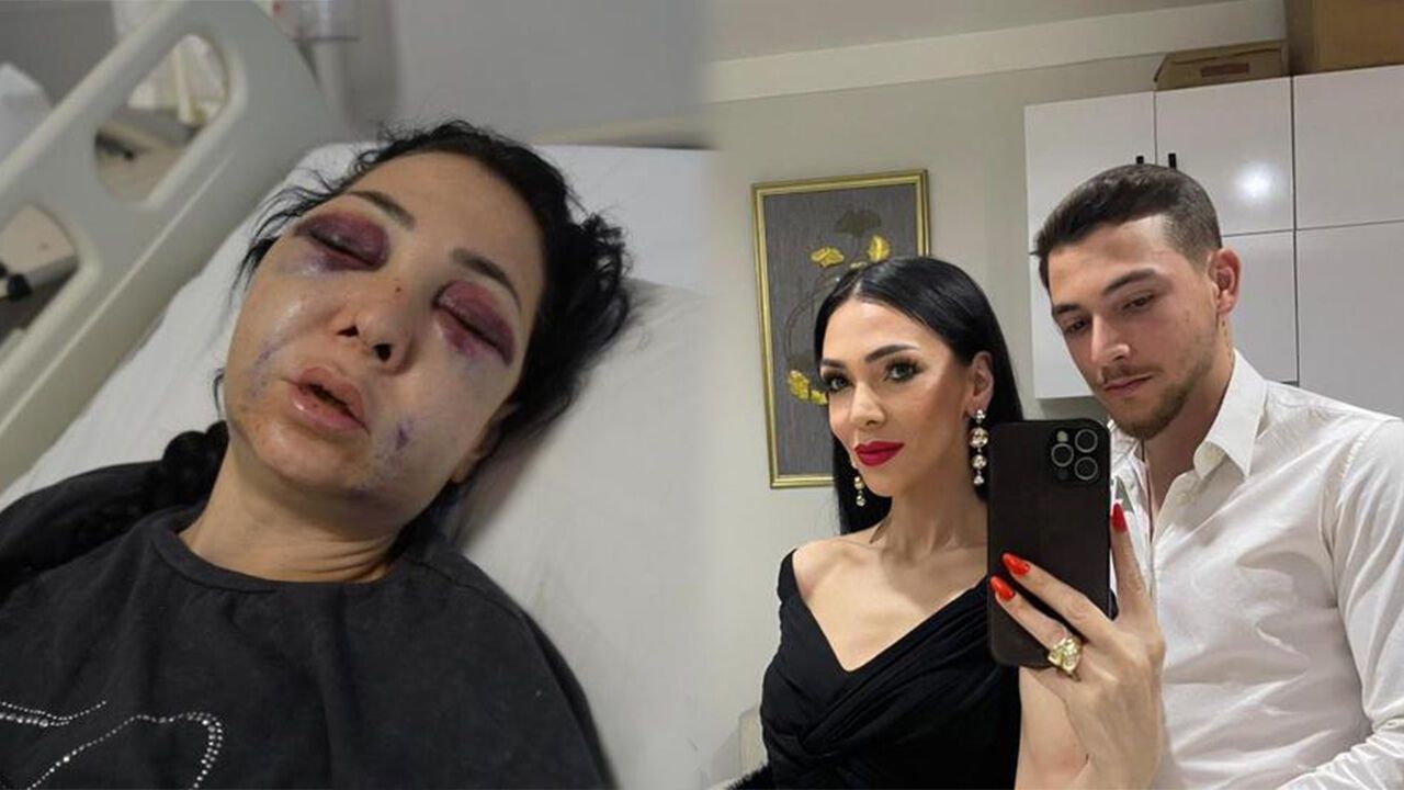 oglunun-onunde-olduresiye-dovduler