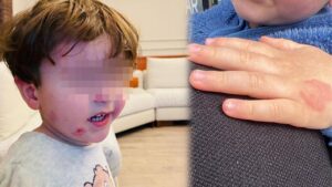 Kreşe Bıraktığı Çocuğunu Darp Edilmiş Halde Aldı