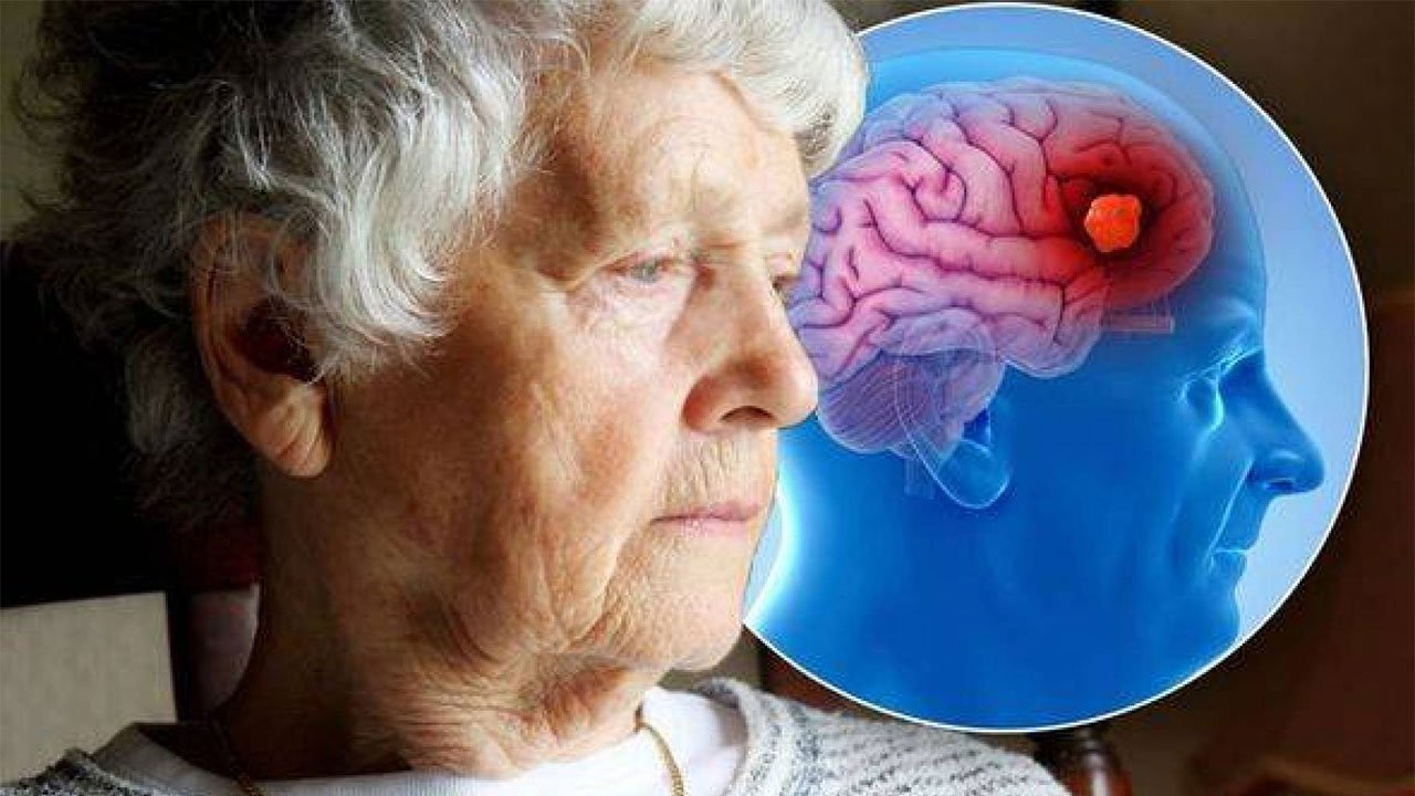 demans-surecinde-ailelere-uyarilar