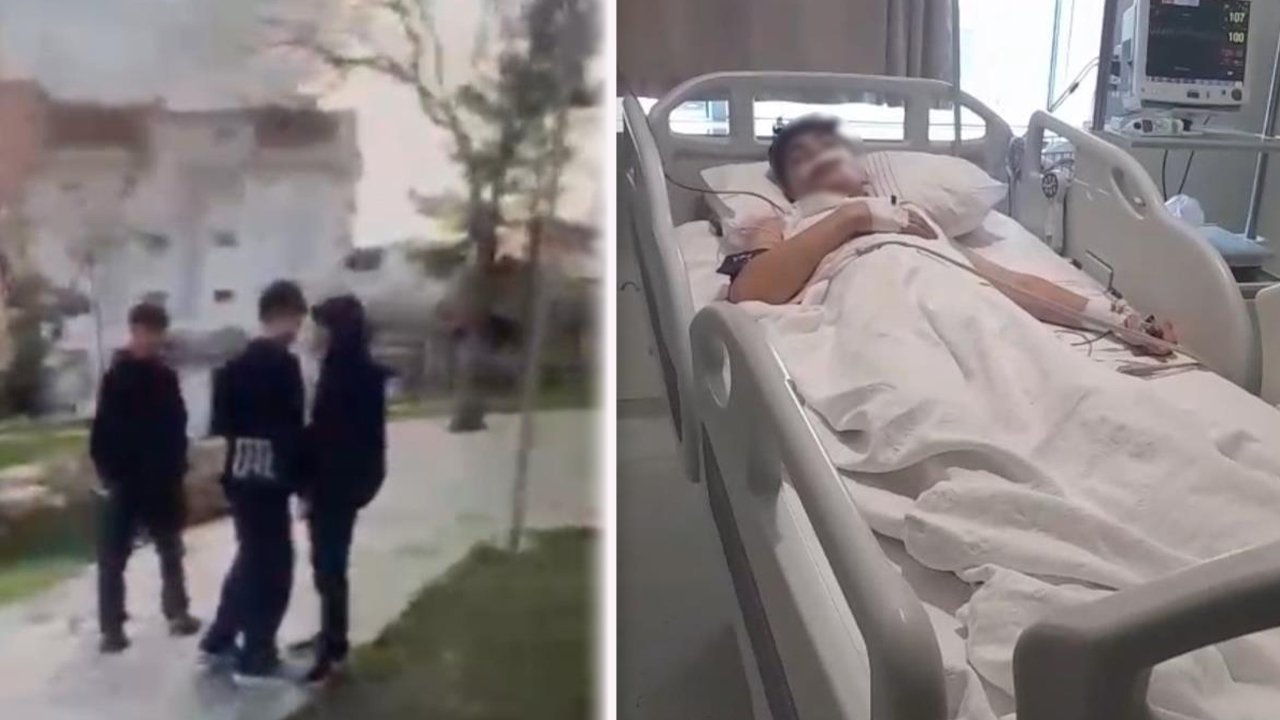 yasitini-bicakla-agir-yaralayan-cocuk-saldiri-anini-da-kayda-aldirdi