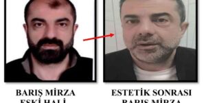 ameliyat-ile-yuzunu-degistirdi!-firari-cinayet-zanlisi-yakalandi