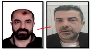 ameliyat-ile-yuzunu-degistiren-zanli,-7-yil-sonra-yakalandi