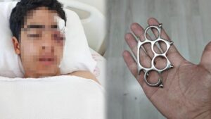 15-yasindaki-cocuk-mustayla-olduresiye-dovuldu