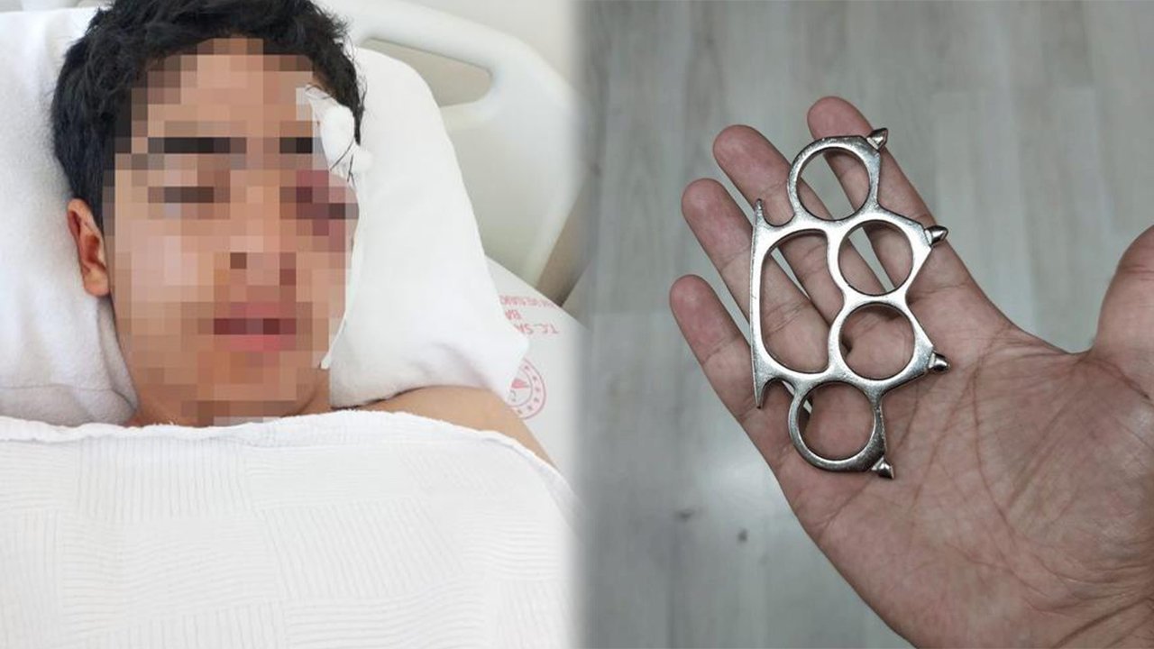 15-yasindaki-cocuk-mustayla-olduresiye-dovuldu