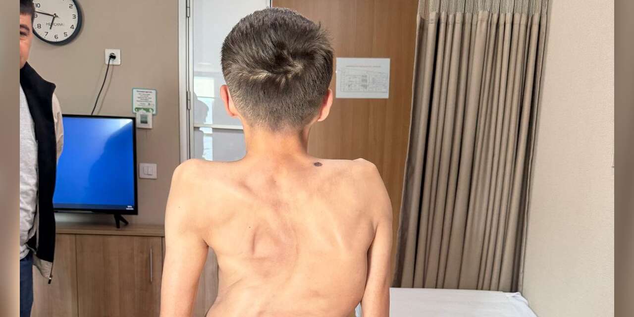 kirgizistanli-genc-sifayi-turk-hekimlerinde-buldu