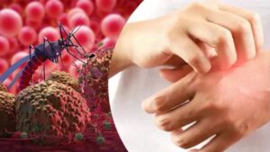 kirikkale’de-sitma-uyarisi:-riskli-ulkelerden-donenler-dikkat