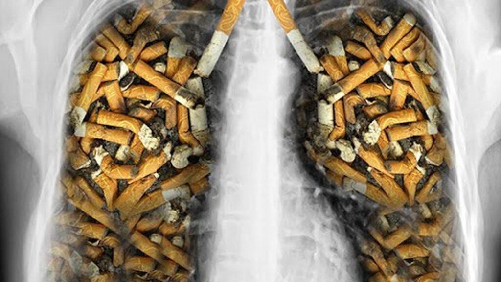 akciger-kanserinin-en-onemli-nedeni-sigara