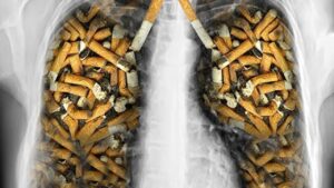 akciger-kanserinin-en-onemli-nedeni-sigara