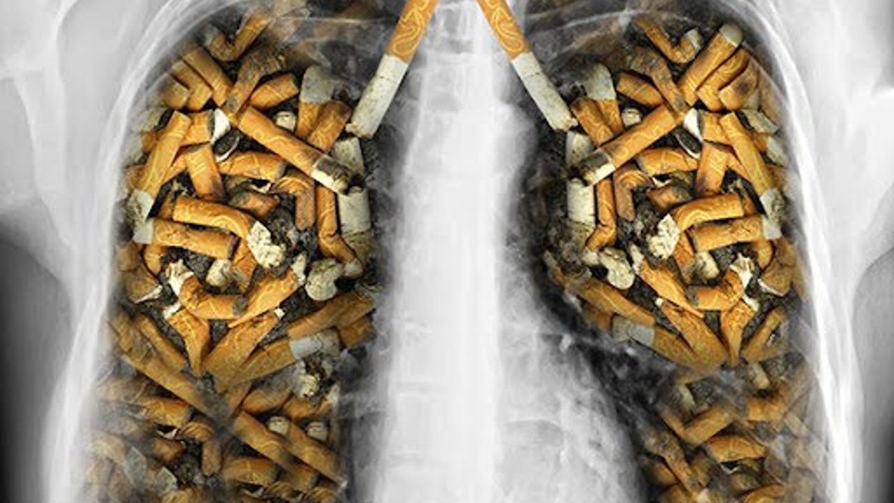 akciger-kanserinin-en-onemli-nedeni-sigara