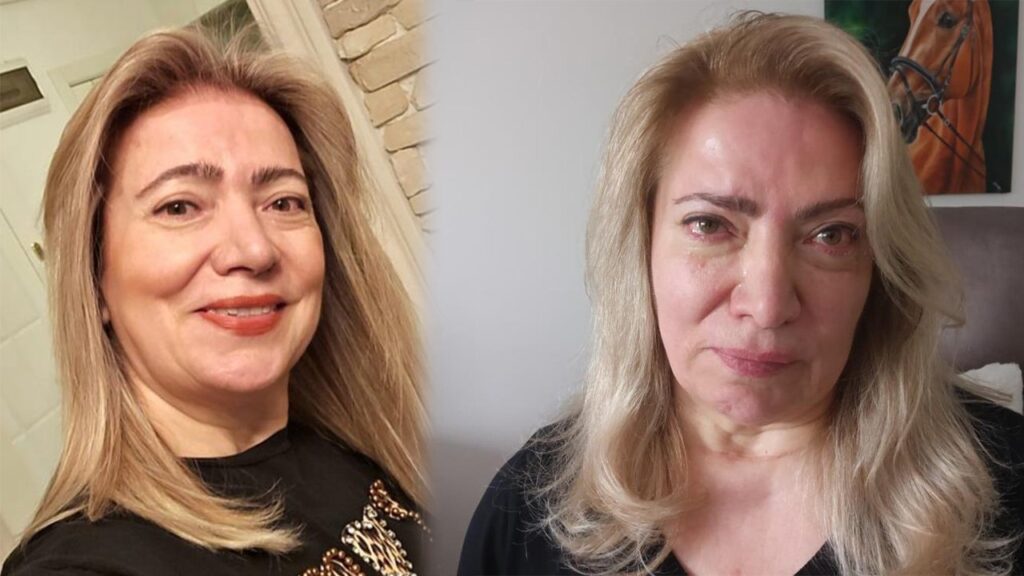 guzellik-merkezinde-estetik-operasyonu-yuz-felci-yapti
