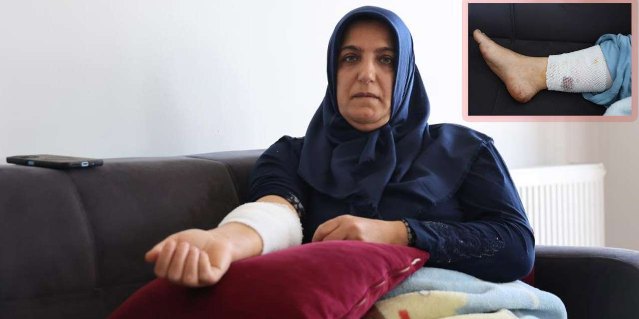 kirikkaleli-ogrenci-okuluna-gidemeden-annesi-hastanelik-oldu:-terminalde-kan-donduran-kopek-saldirisi